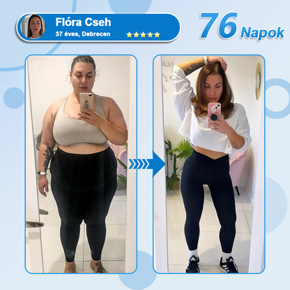 🎁FormaÉlet® 🌱Nano Mikrotű Tapasz SMGT-GLP-1-tel és Matrixyl 3000-rel – Fogyás, Bőrfeszesítés, Vércukorszint-támogatás, Injekció Nélkül, 7 Napos Eredmény 🎁