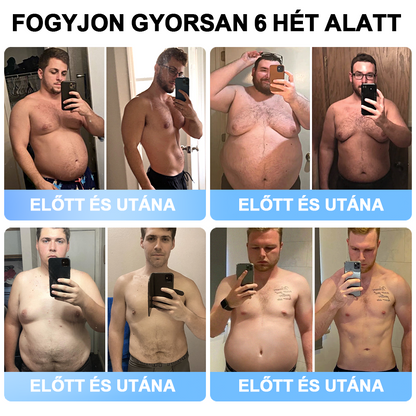 🎁FormaÉlet® 🌱Nano Mikrotű Tapasz SMGT-GLP-1-tel és Matrixyl 3000-rel – Fogyás, Bőrfeszesítés, Vércukorszint-támogatás, Injekció Nélkül, 7 Napos Eredmény 🎁