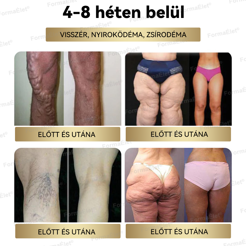 🏆 Hivatalos üzlet | FormaÉlet® GLP-1 Moringa Fogyókúrás és Egészségfokozó cseppek 🔥 (Élelmiszer-minőségű zsírégető – Az Obesity Society fejlesztése)