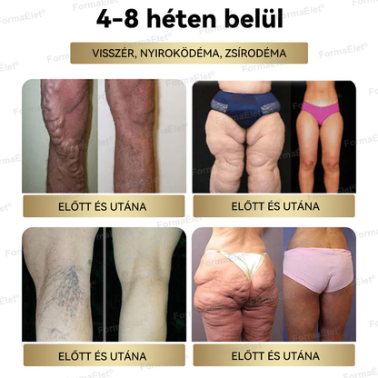 🏆 Hivatalos üzlet | FormaÉlet® GLP-1 Moringa Fogyókúrás és Egészségfokozó cseppek 🔥 (Élelmiszer-minőségű zsírégető – Az Obesity Society fejlesztése)