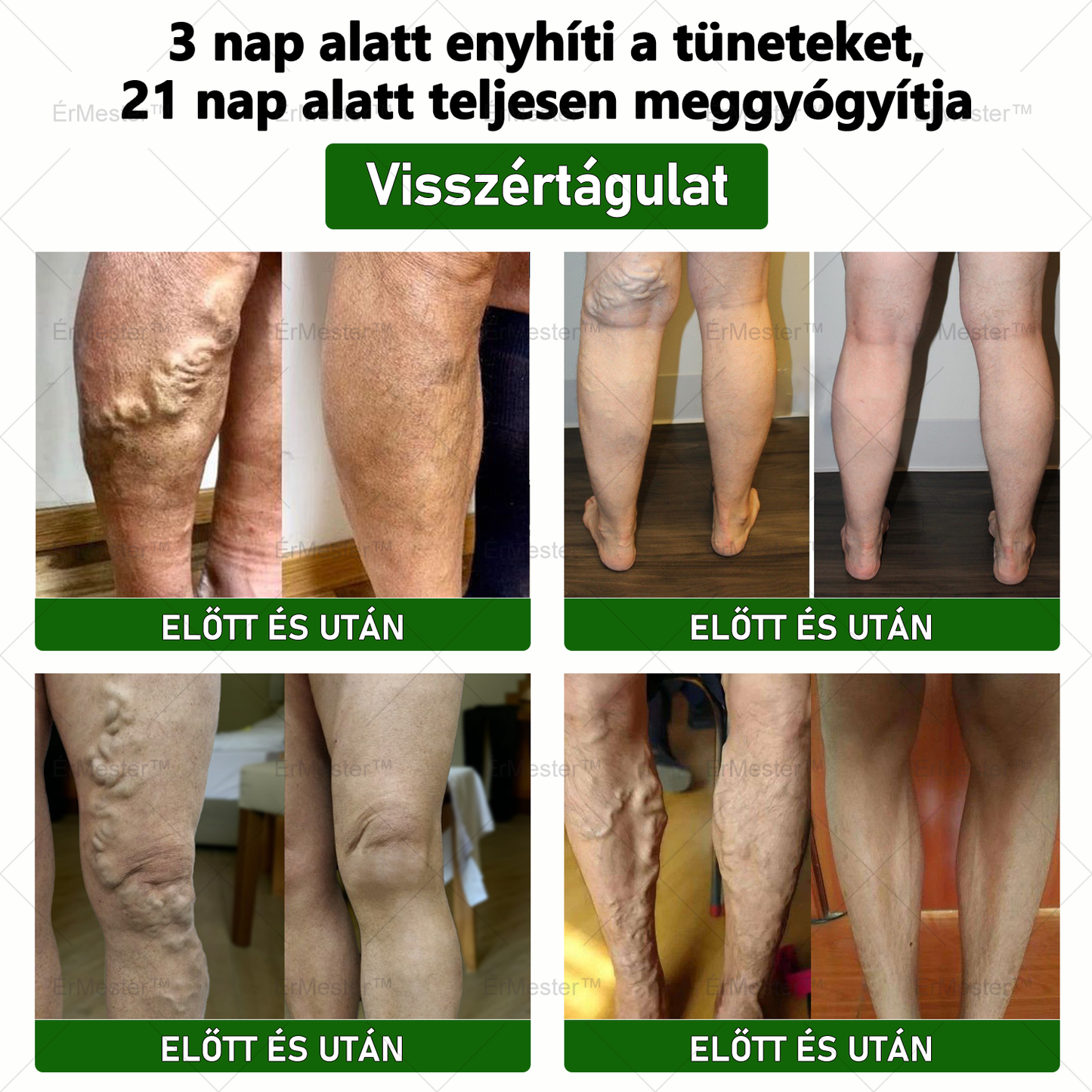 ❣️ ÉrMester™  Természetes Vénás Javító Lábfürdő Gélgolyók