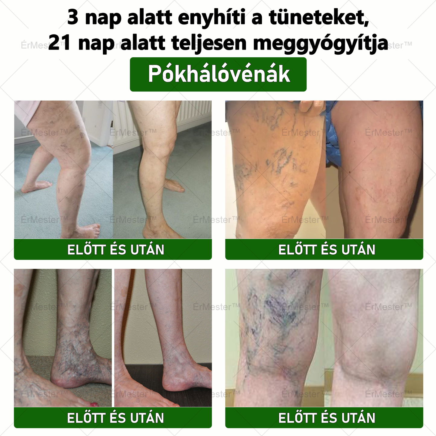 ❣️ ÉrMester™  Természetes Vénás Javító Lábfürdő Gélgolyók