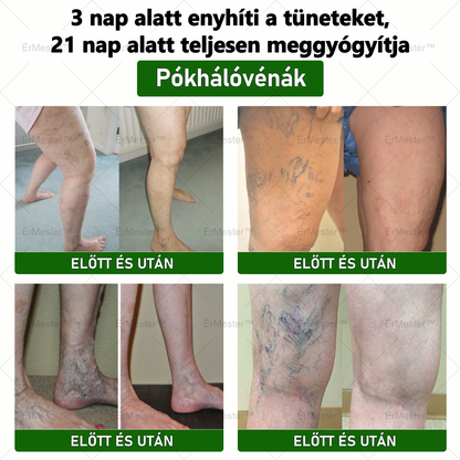 ❣️ ÉrMester™  Természetes Vénás Javító Lábfürdő Gélgolyók