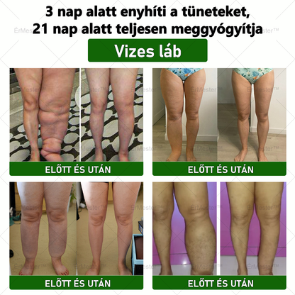❣️ ÉrMester™  Természetes Vénás Javító Lábfürdő Gélgolyók