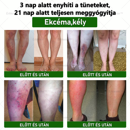❣️ ÉrMester™  Természetes Vénás Javító Lábfürdő Gélgolyók