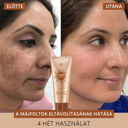 ✨ 𝐅𝐑𝐈𝐒𝐒𝐀𝐑𝐂™ Fehérítő És Folteltávolító Arcmaszk | Természetes összetevők tartósan eltüntetik a foltokat, szeplőket és napfoltokat🔥
